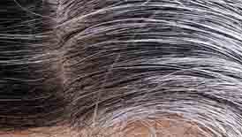 gray hair,grey hair,home remedies for gray hair,grey hair remedy,grey hair treatment,premature grey hair,treatment for grey hair,white hair to black hair naturally,natural remedies for grey hair,home remedies for grey hair,remedies for grey hair,homemade oil for grey hair,reverse grey hair,natural remedy for grey hair,remedy to treat grey hair,black hair naturally,premature grey hair remedy,white hair,how to stop grey hair,cure for gray hair
