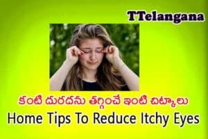 కంటి దురదను తగ్గించే ఇంటి చిట్కాలు,Home Tips To Reduce Itchy Eyes