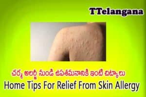 చర్మ అలర్జీ నుండి ఉపశమనానికి ఇంటి చిట్కాలు,Home Tips For Relief From Skin Allergy