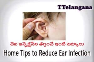 చెవి ఇన్ఫెక్షన్‌ని తగ్గించే ఇంటి చిట్కాలు,Home Tips to Reduce Ear Infection