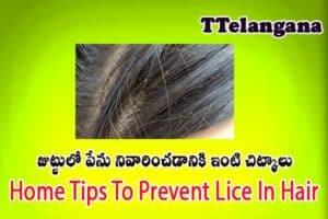 జుట్టులో పేను నివారించడానికి ఇంటి చిట్కాలు,Home Tips To Prevent Lice In Hair